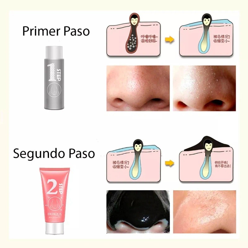 Tratamiento 3 Pasos Puntos Negros Granos, Espinillas Nariz F