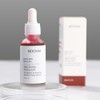 TFixol Solución Exfoliante con 30 ml de AHA 30 BHA