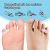 Welnove Pack of 10 Bunion Correction, Toe Separators with 2