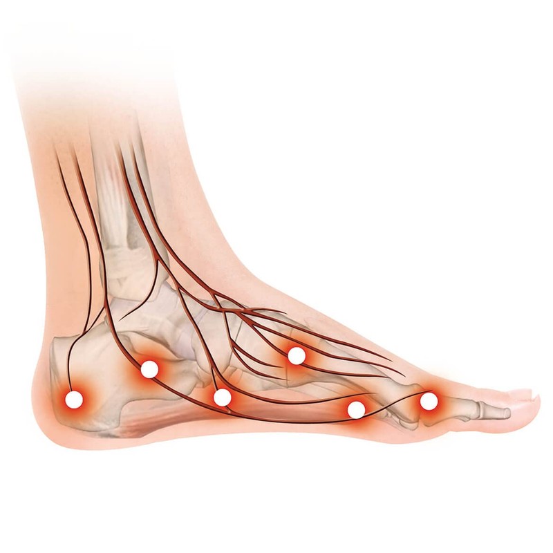 Dream Products Neuropathy Therapy Socks 1 Pair