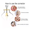 SJTR Corrector De Uñas Enterradas Pies Y Manos Encarnadas