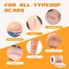 NAYSAYE Silicone Scar Tape, Silicone Scar Sheets for Surgical Scars,