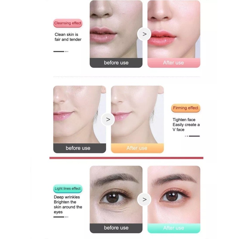 Foto Rejuvence Electroestimulador Facial-lifting Fotónico Con Luz Red/blue