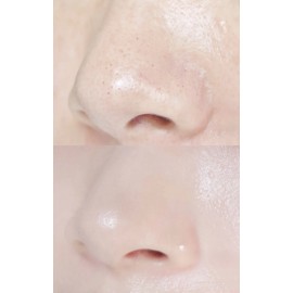 CNP Laboratory Mild Anti-pore Black Head Clear Kit 4 times