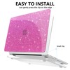 AKIT Compatible with MacBook Pro 14 inch Case Sparkly 2025-2021