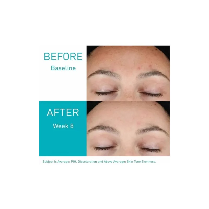 2pcerave Gel Control Imperfecciones Con Ácido Salicílico 40m