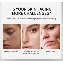 Arbutin 7% + Tranexamic Acid 4% Cream, 70,000ppm Arbutin, 40,000ppm TXA, Niacinamide, Glutathione, Dark Spots, Freckle, Blemishes, Pigmentation, Korean Skin Care, 50ml 1.69fl.oz (2)