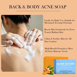 Bacne Out Bar Soap with Turmeric, Vitamin C & Alpha-Arbutin