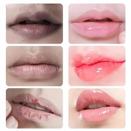Fast Lightening Pink Mouth Lips Serum Bleaching Permanent Remove Dark Smoke Lips Lip Balm Moisturize Gloss Lipstick Lip Mask - Color: 1PCS