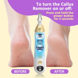 Mfish Electric Callus Remover for Feet, Rechargeable Foot File with Digital Display, 9 Speeds & 8 Grinding Heads, Professional Pedicure Tool for Thick Calluses, Cracked Heels & Hard Skin White