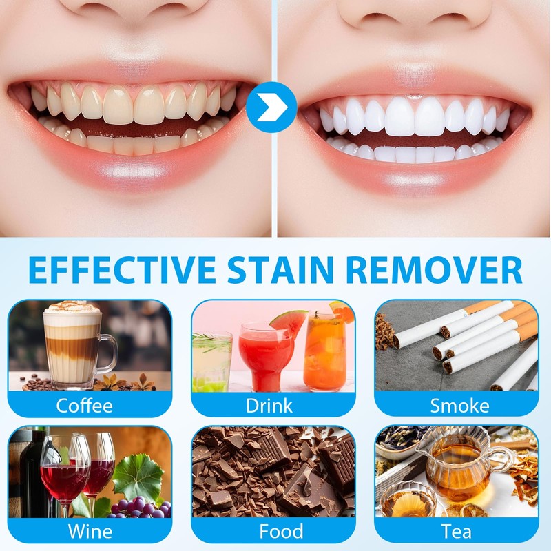 Teeth Whitening Set, Teeth Whitening Essence, Professional Teeth Whitening Set,