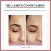 Eucerin Serum Facial Anti Manchas Anti Pigment ,30ml Sensible Día/noche