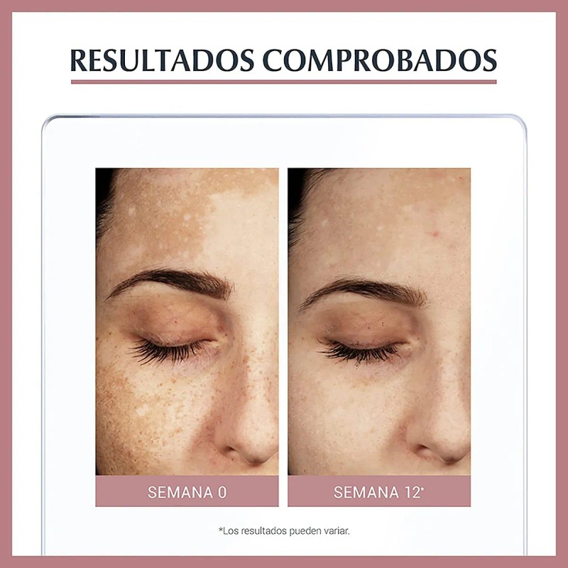 Eucerin Serum Facial Anti Manchas Anti Pigment ,30ml Sensible Día/noche