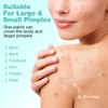 BUTBU Pack of 10 Large Pimple Patches, 60 x 60