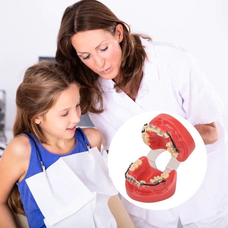 Professional Dental Demonstration Orthodontic Model with Metal Wires and Bracket
