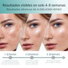 Abera Melasma Sérum, Suero Facial Despigmentante, Tratamiento para Melasma y