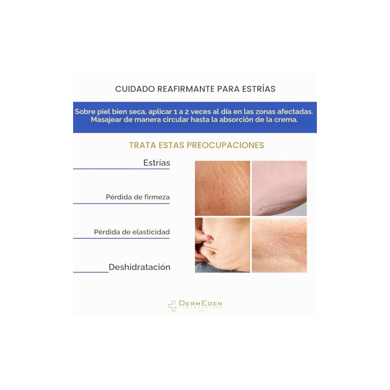 DERMEDEN Crema reafirmante para el cuidado de las marcas elásticas