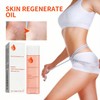 125ml Stretch Mark Oil & Scar Treatment, Skin Regeneration Oil