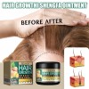 Crema Capilar De Jengibre Para El Crecimiento Del Cabello