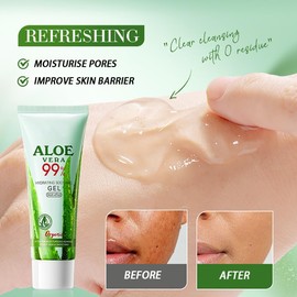 99% Pure Aloe Vera Gel for Skin Care – Soothes Sunburn, Itchy & Damaged Skin. Enriched with Vitamin E for Hydration & Healing. Perfect for Daily Skincare & Post-Sun Relief