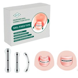 Ingrown Toenail Treatment & Removal Kit - at Home Treatment for Ingrown Toenails, Titanium Alloy Ingrown Toenail Corrector, Nail Tools for Curved Nail Repair Suitable for Men Woman (((0.59/0.67in)))