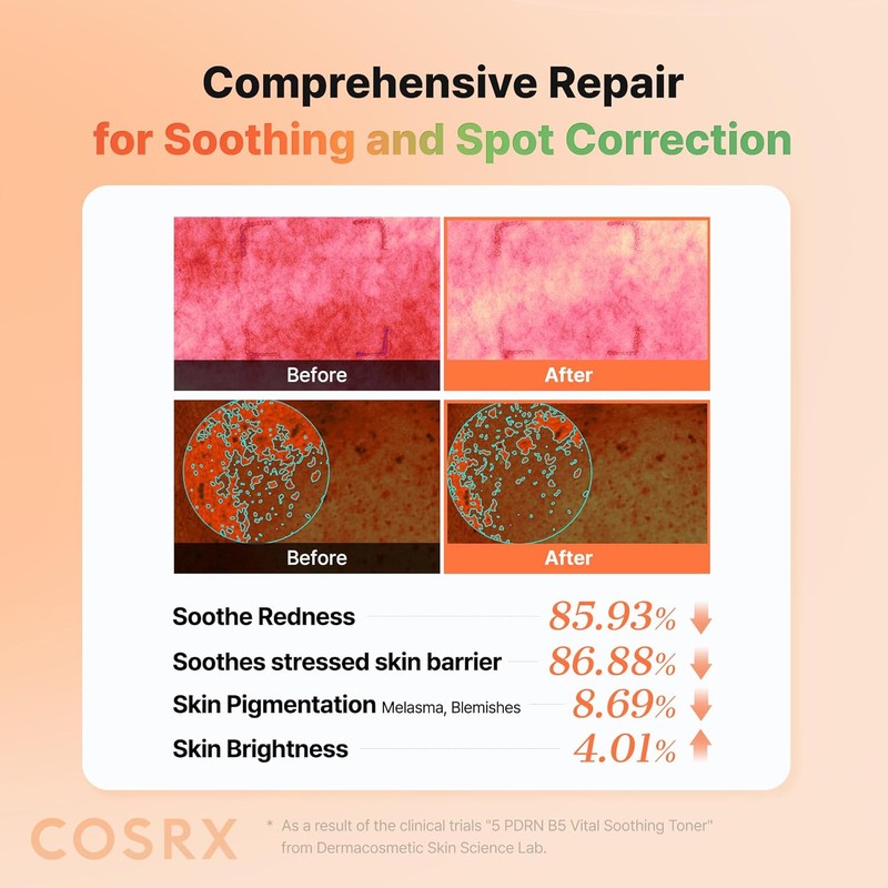 COSRX [COSRX]5 PDRN B5 Vital Soothing Toner 280ml
