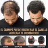 Hair Shampoo, Root Activator Shampoo, Hair Loss Shampoo for Men,