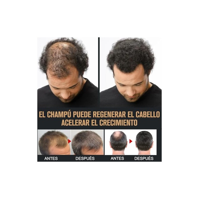 Hair Shampoo, Root Activator Shampoo, Hair Loss Shampoo for Men,