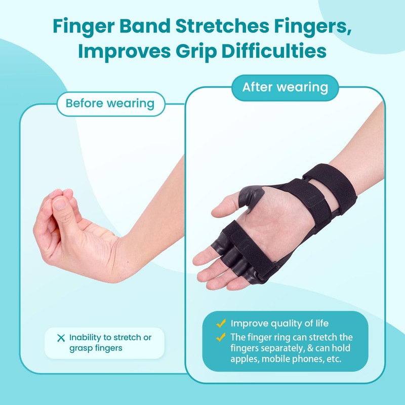 Radial Nerve Palsy Splint Brace for Wrist drop, 5 Fingers