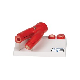 Vascular model that reproduces the state of plaque buildup inside the vessel, arosclerosis model, with cross-section relief, 2 breakdown - 3B Scientific