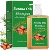 1PCS Shampoo Romero,Champú de Aceite Battana de 300 ml para