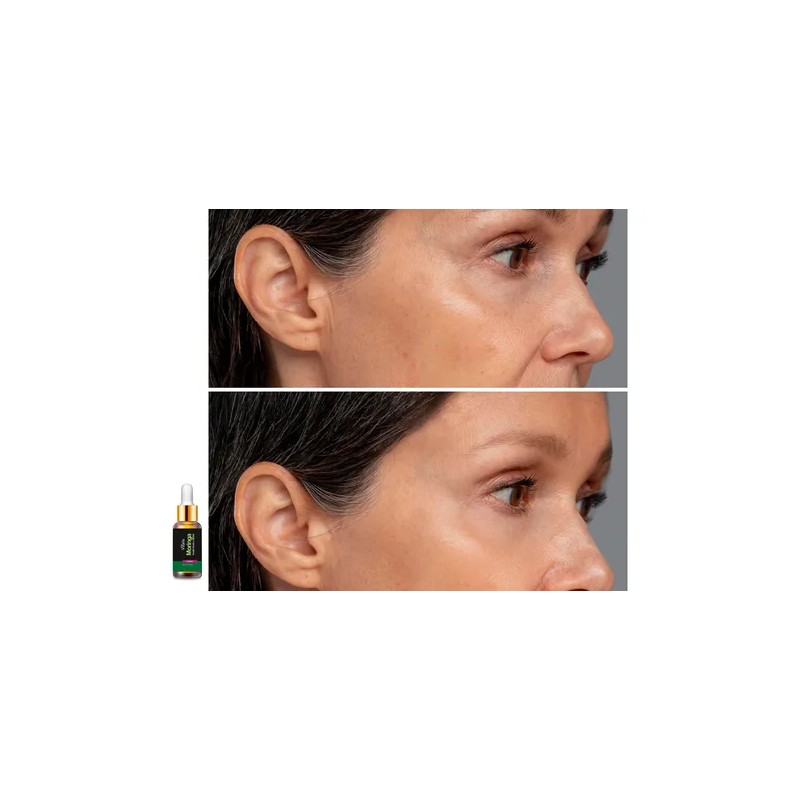 Crema + Aceite De Moringa Antiarrugas Antimanchas Antiedad