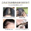HIYE 部分ウィッグ 人毛100% 分け目専用 頭頂部 自然 つむじ 白髪隠し 人工肌 トップカバー