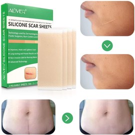 Hojas de silicona para eliminar cicatrices, hojas avanzadas de silicona para cicatrices causadas por cesárea, cicatrices corporales, cirugía, quemaduras, lesiones acné y estrías parches, 4 hojas reutilizables para cicatrices(3"×1.6")