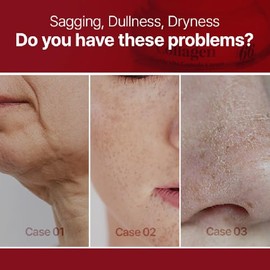Crema facial de colágeno crema de colágeno marino Niacinamida y colágeno hidrolizado liofilizado Aumenta la firmeza