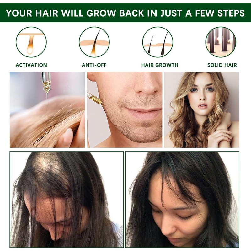 Aceite de Romero para El Cabello,30ml Rosemary Oil for Hair