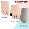 LELEYO Toe Sacks, for Small Toes, Protection, New Material, Breathable,