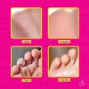 Exfoliante Pies Callos Resequedad Suavidad Repara Neutra