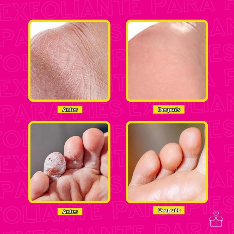 Exfoliante Pies Callos Resequedad Suavidad Repara Neutra