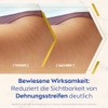 NIVEA Body Öl-Serum Anti-Dehnungsstreifen 100ml