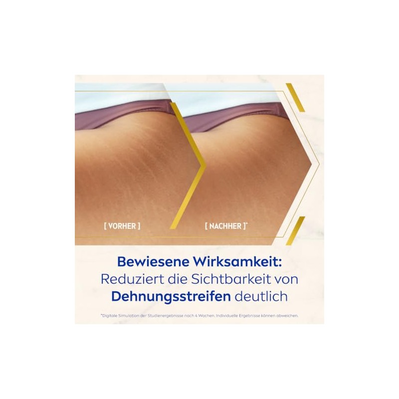 NIVEA Body Öl-Serum Anti-Dehnungsstreifen 100ml
