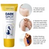 Dark Spot Remover for Face and Body: Advanced Corrector Cream