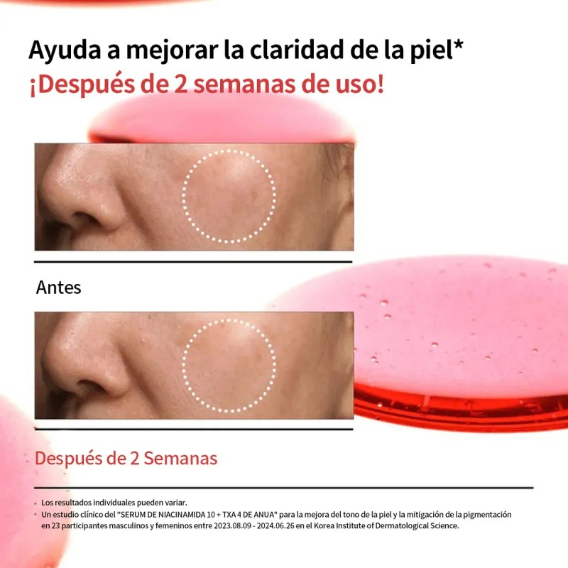 Kit Serums Niacinamida + Txa Y Ácido Azelaico Anti-manchas