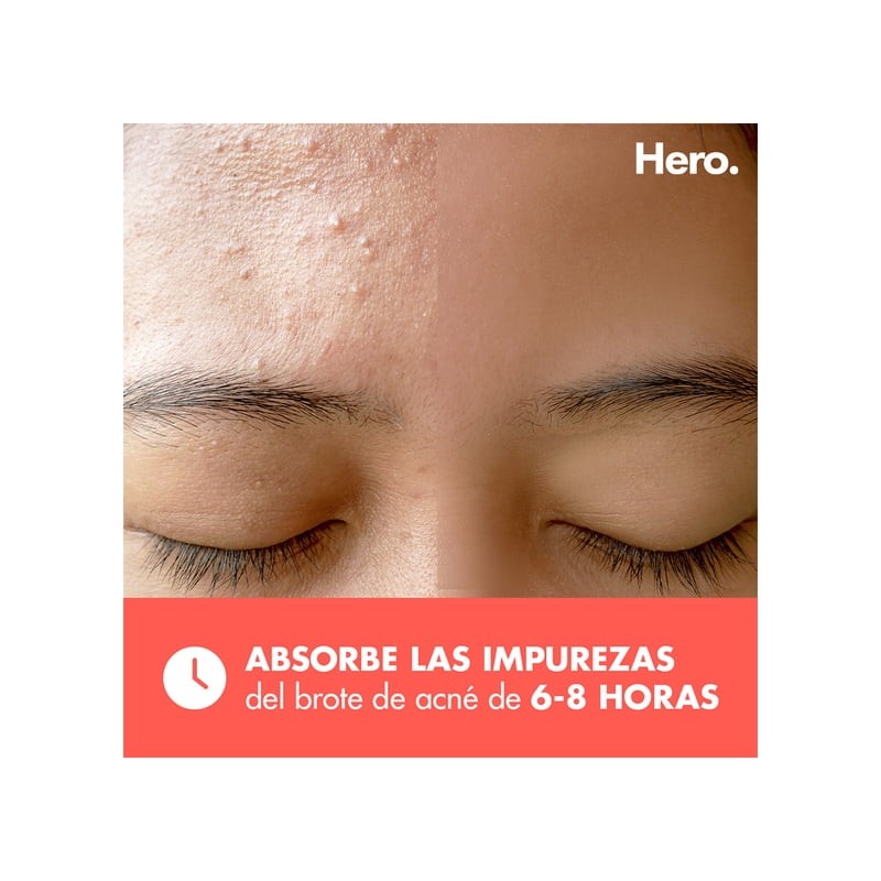 Parches para acné Hero Migthy Patch original 24 piezas