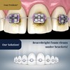 Teeth Whitening for Braces, Braces Cleaner Foam, Brace Teeth Whitening