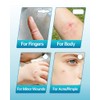 Hydrocolloid Bandages Variety Pack - Thin, Waterproof & Fast Healing
