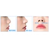 CatMoz 3D Nose Petite 5 Sizes, Improve Dumpling Nose, Pig