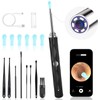High-Definition Ear Wax Removal, Wireless Ear Cleaner, Safe and Gentle