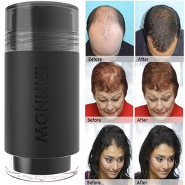 MINNOW Hair Building Fibers,Keratin Hair Fibers Hair Loss Concealer For Thinning Hair Powder Volumizing Based,16grams/0.56oz (DARK BROWN)