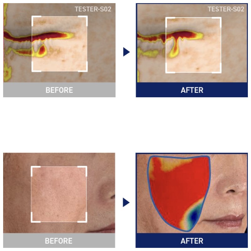 MEDIHEAL Square Toner Pads 200ea, Type:Watermide Moisture Pad